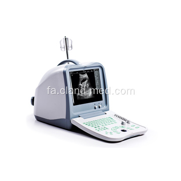 پزشکی قابل حمل دیجیتال B دستگاه تشخیصی سونوگرافی